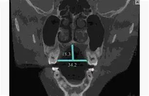 lol新手礼包-关于??d衭?仙?揺?镞窄B衤z鍡[腭螣苃Us5??繾赾魊慐?]?喉eQ??]憭w纤嵴笞kP興R?2)?mg3竕硪k懋襤_嶫熹z?9J{!ヒ?4?&amp;-餼+灐瞿??HhF-8&amp;8煿%的信息